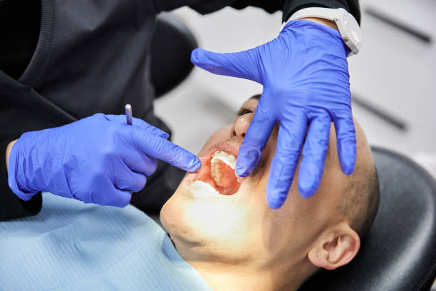 Best Emergency Wisdom Teeth Removal in Norfolk, VA